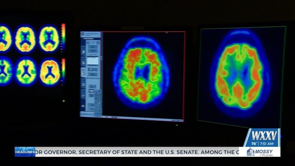 Stroke Awareness Month: Memorial Hospital Highlights Warning Signs, Risks