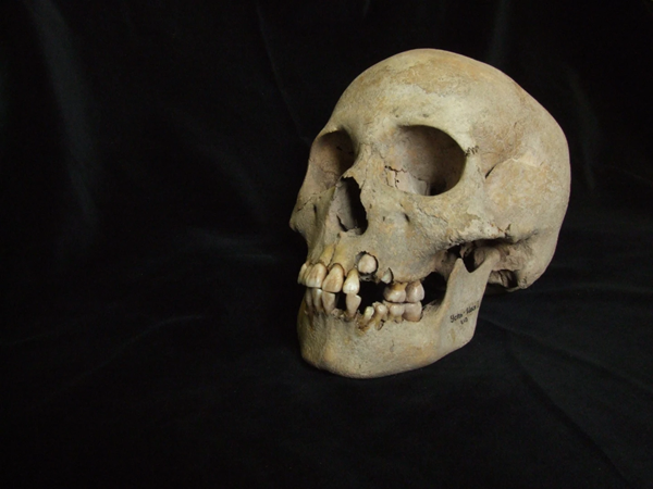 Teeth