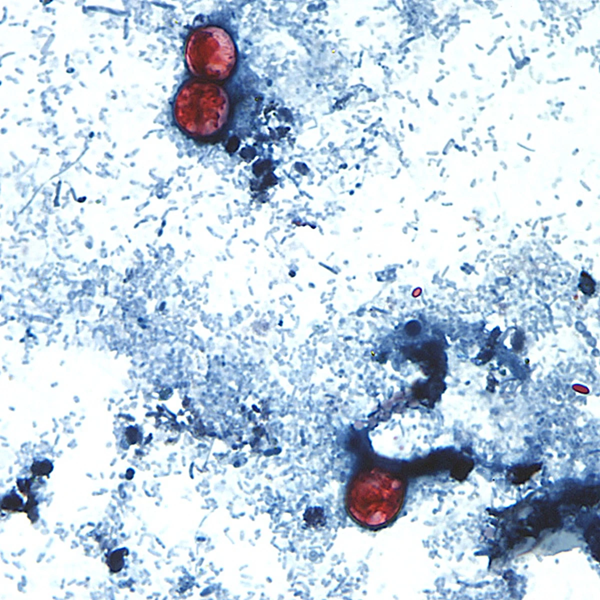 Parasite