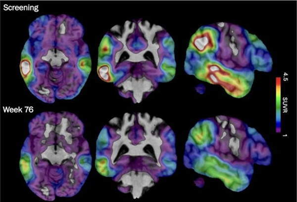 Brain Scan