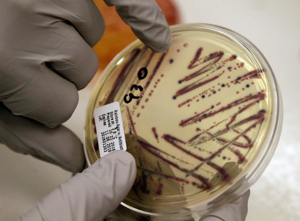 E Coli