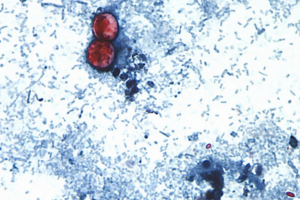 Cyclosporia